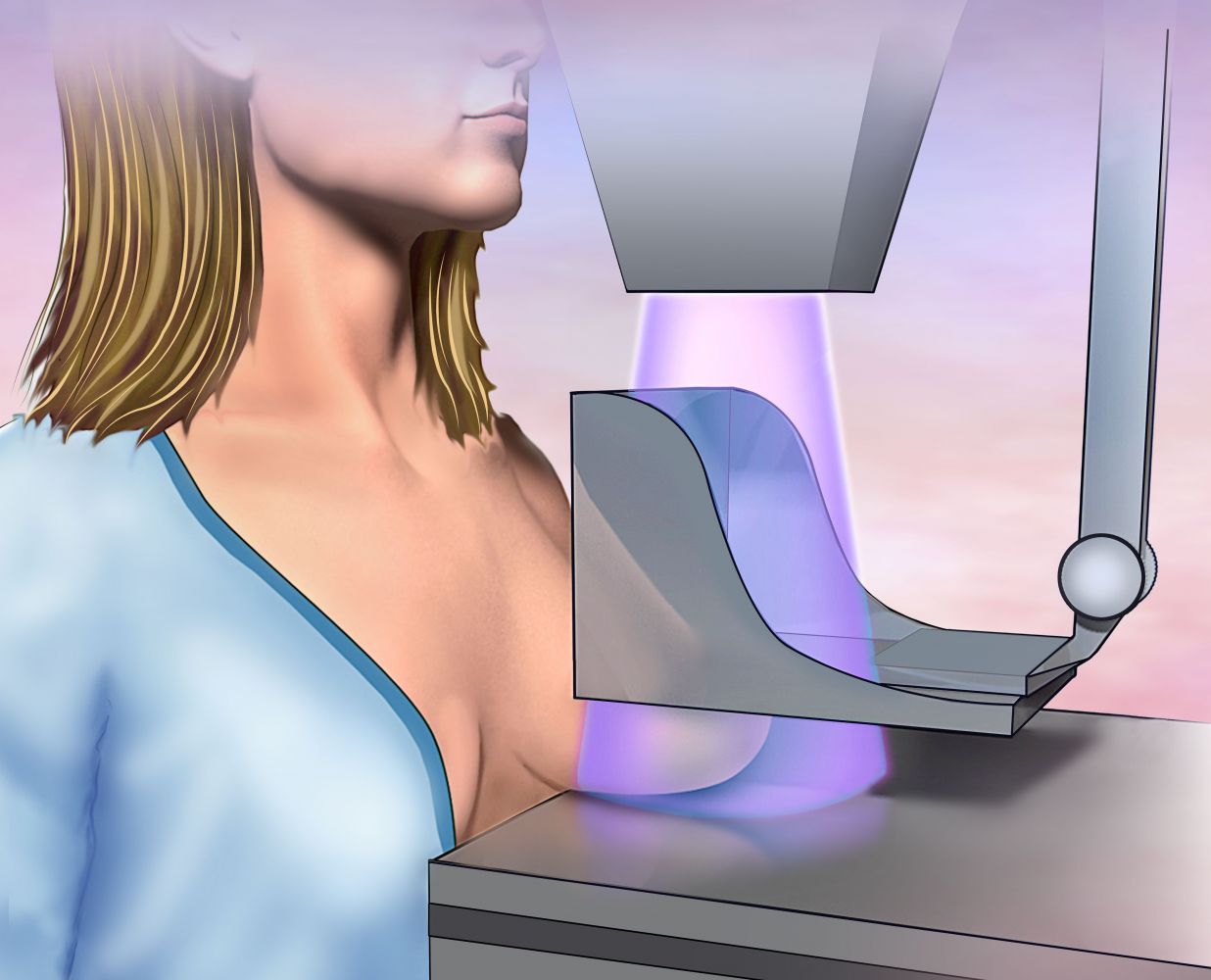 Ограничения и недостатки рентгеновской маммографии